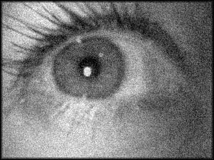 Eye